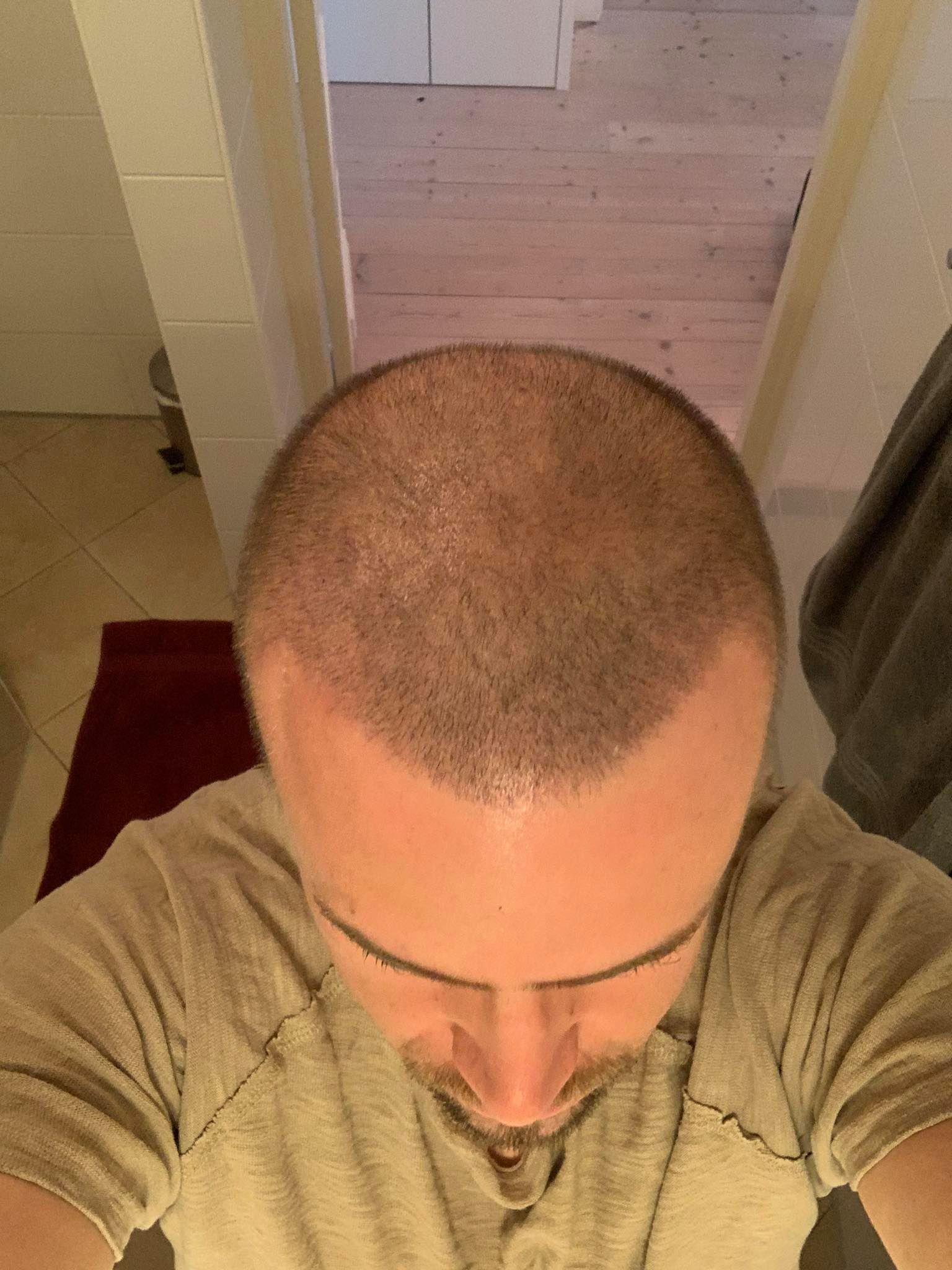 /foren/transplant/index.php/fa/48138/0/