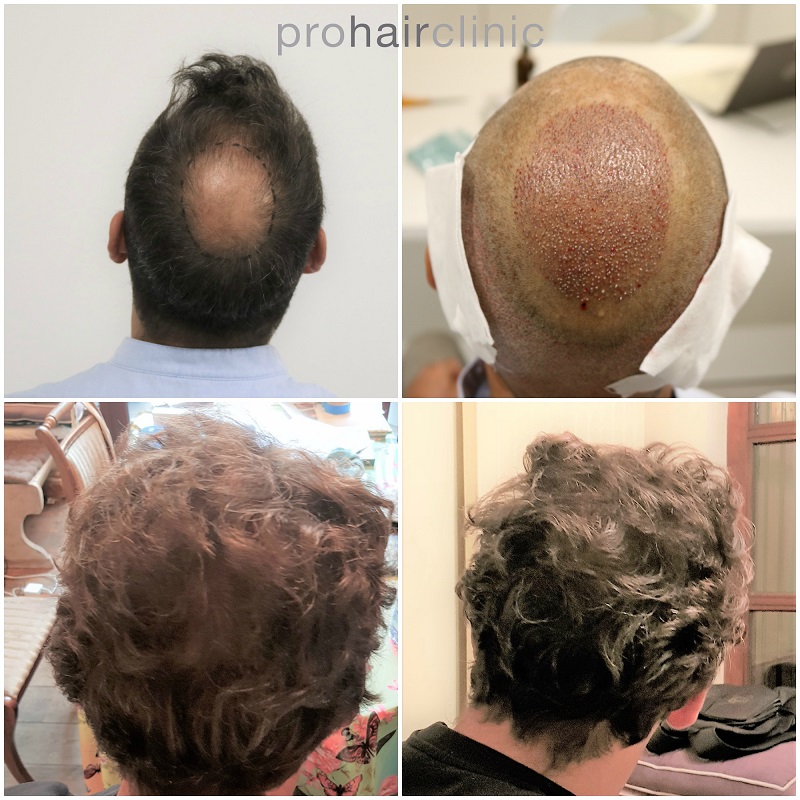 /foren/transplant/index.php/fa/48154/0/