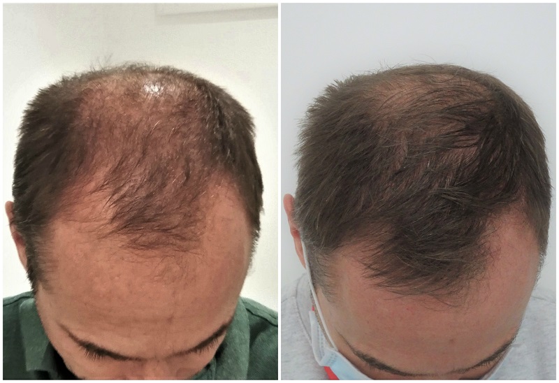 /foren/transplant/index.php/fa/48181/0/