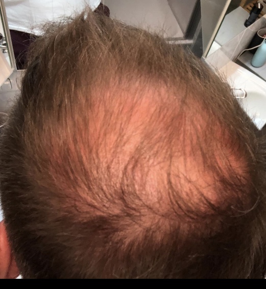 /foren/transplant/index.php/fa/48199/0/