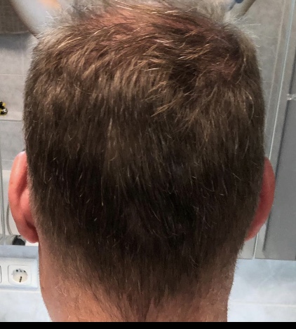 /foren/transplant/index.php/fa/48200/0/