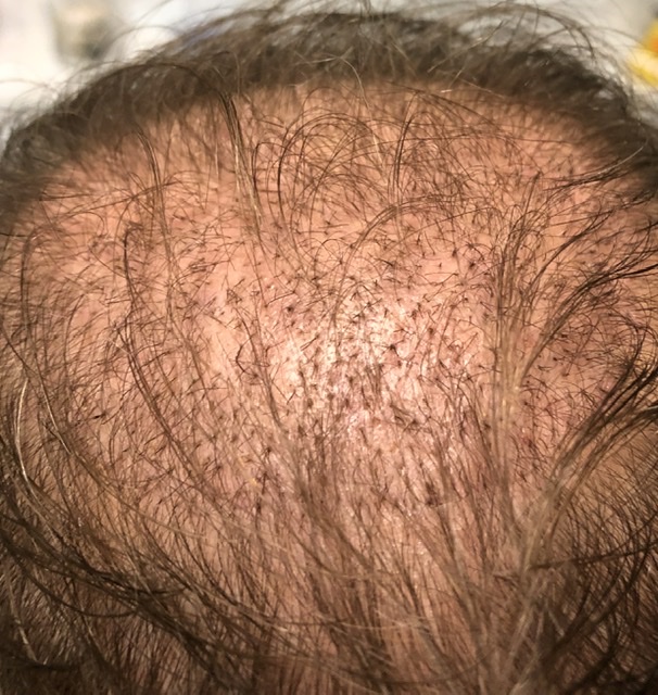 /foren/transplant/index.php/fa/48216/0/