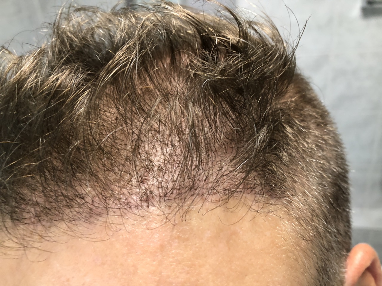 /foren/transplant/index.php/fa/48221/0/