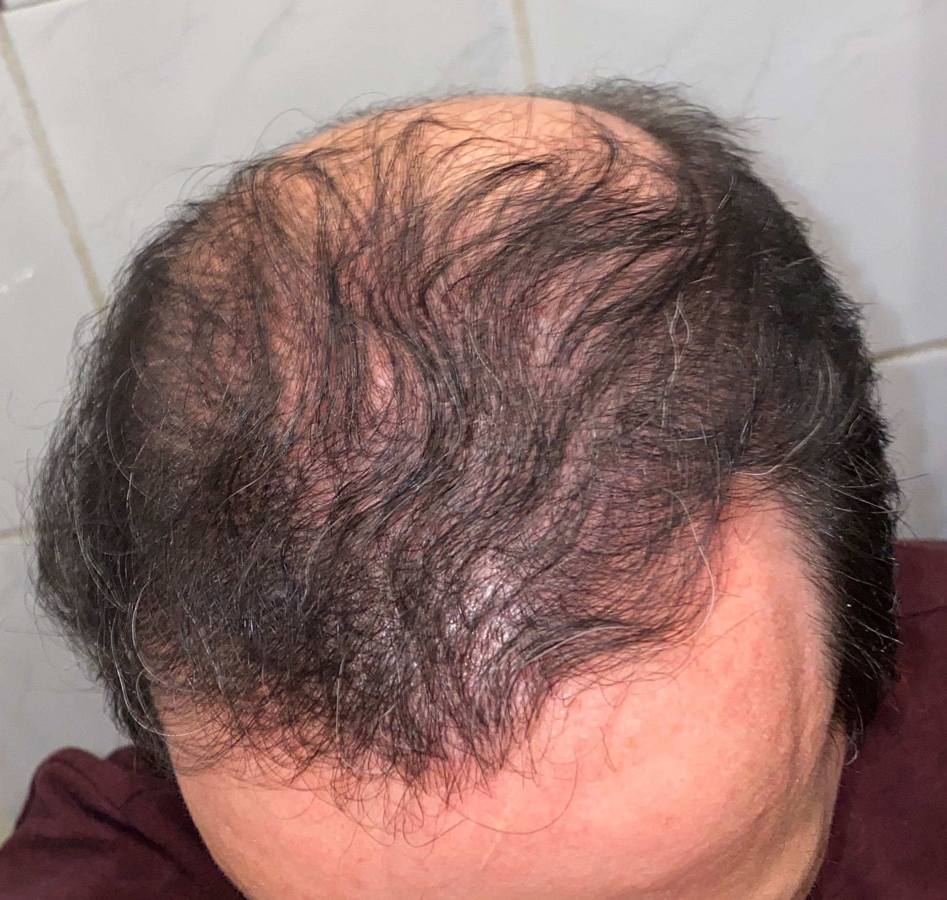 /foren/transplant/index.php/fa/48294/0/