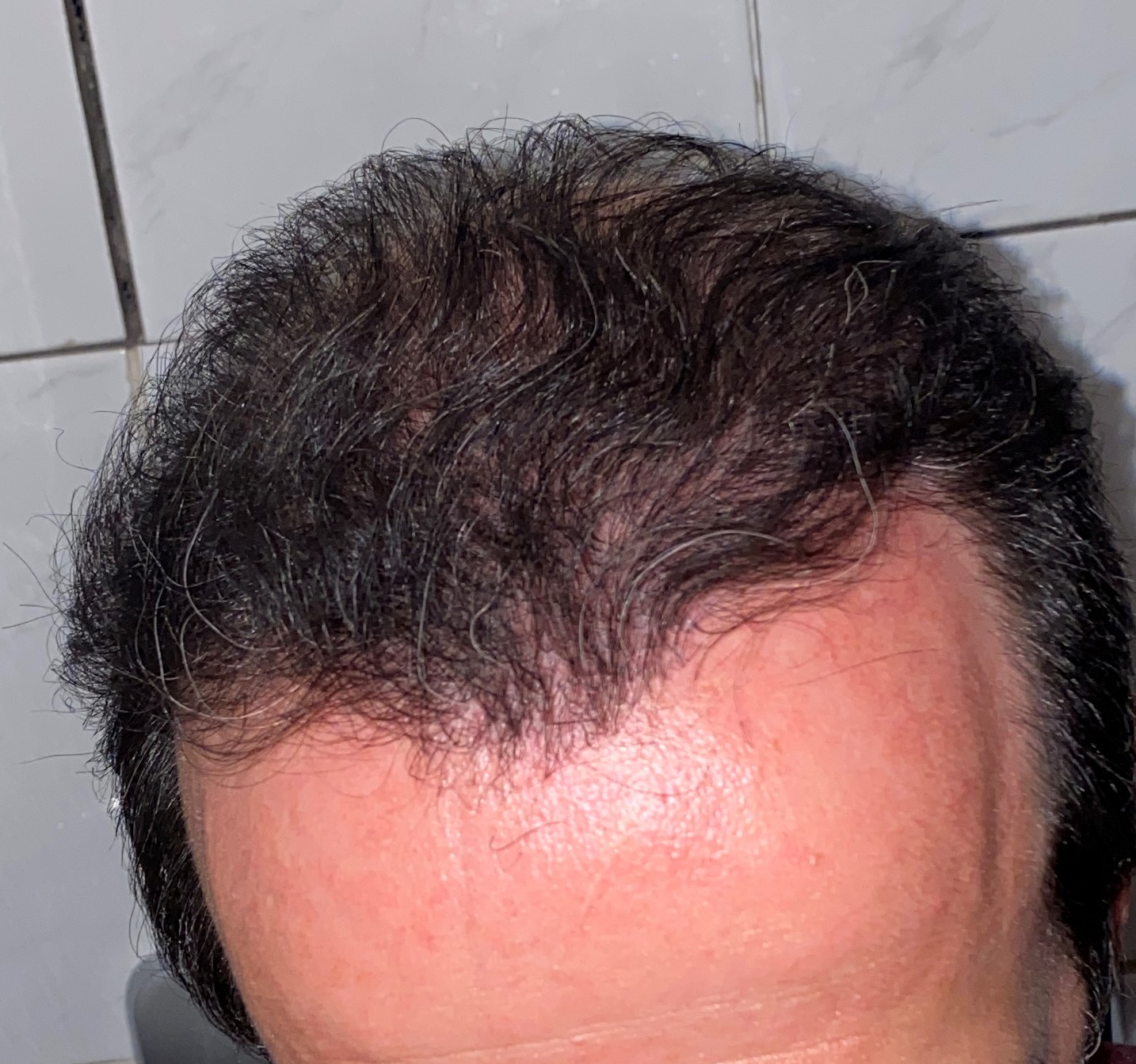 /foren/transplant/index.php/fa/48295/0/