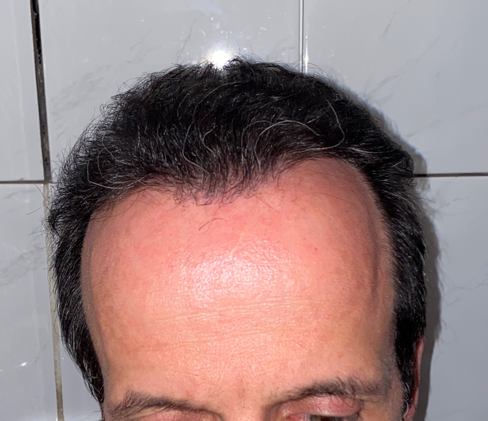 /foren/transplant/index.php/fa/48297/0/