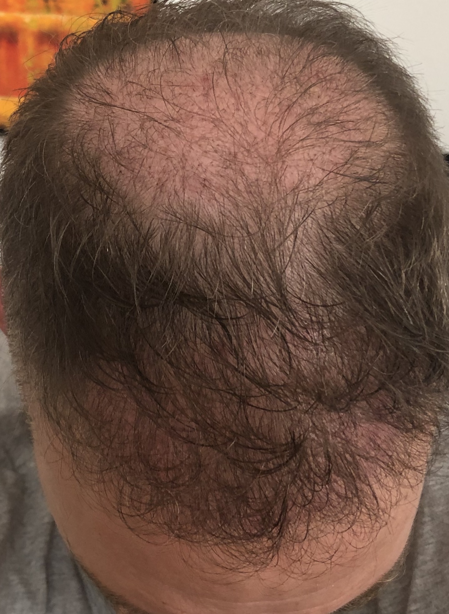 /foren/transplant/index.php/fa/48374/0/