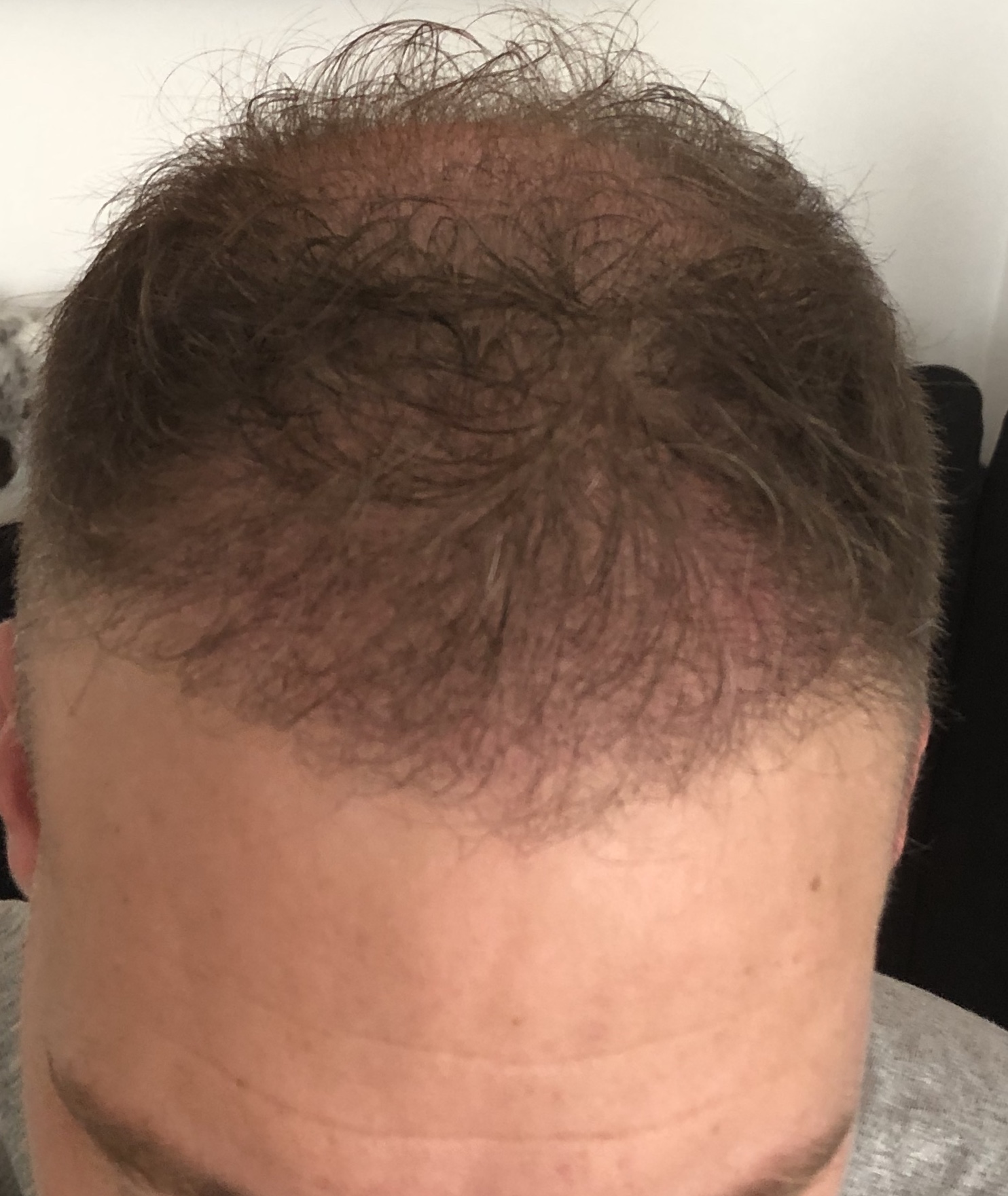 /foren/transplant/index.php/fa/48375/0/