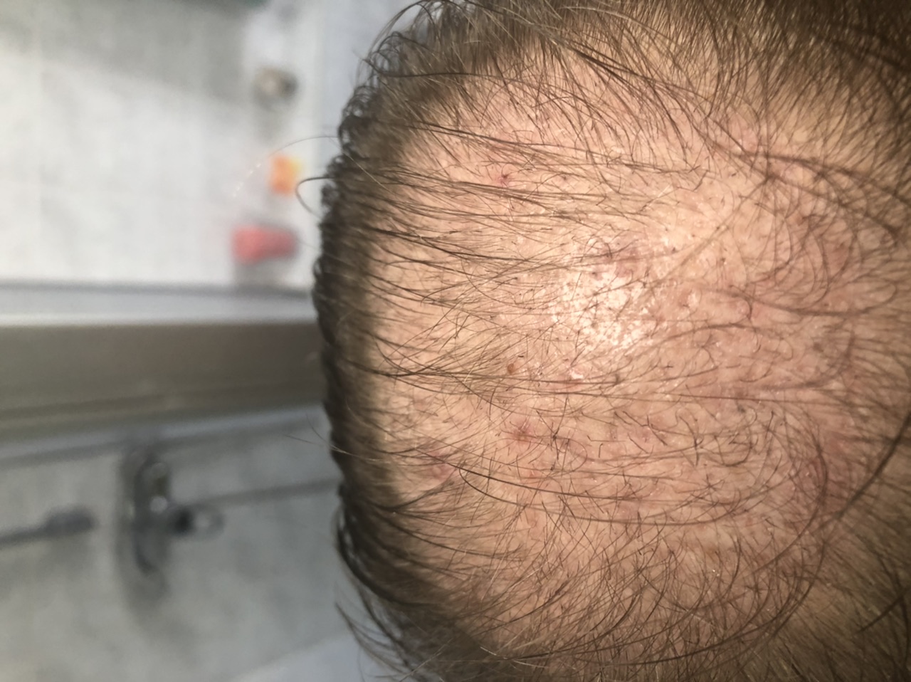 /foren/transplant/index.php/fa/48379/0/