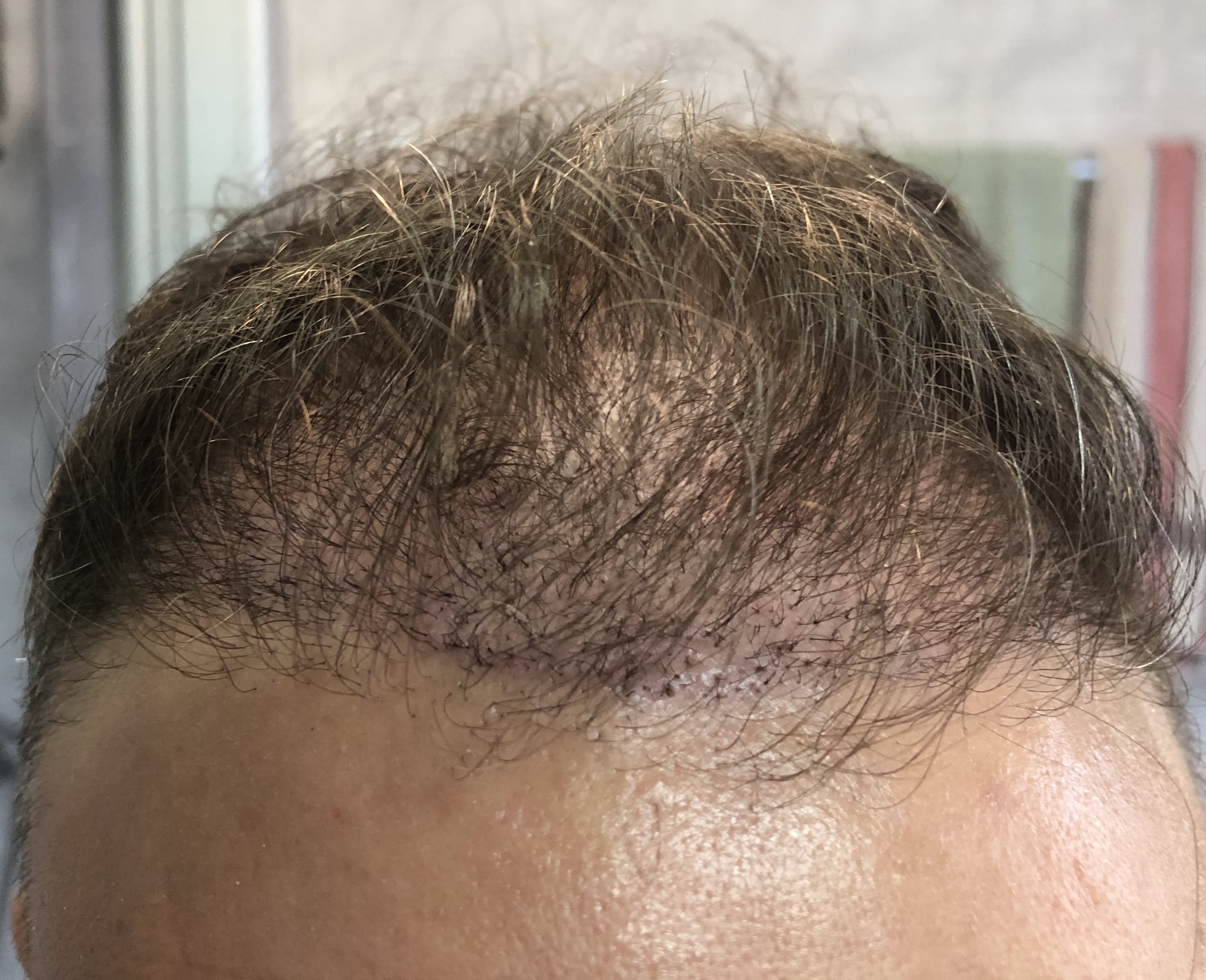 /foren/transplant/index.php/fa/48411/0/