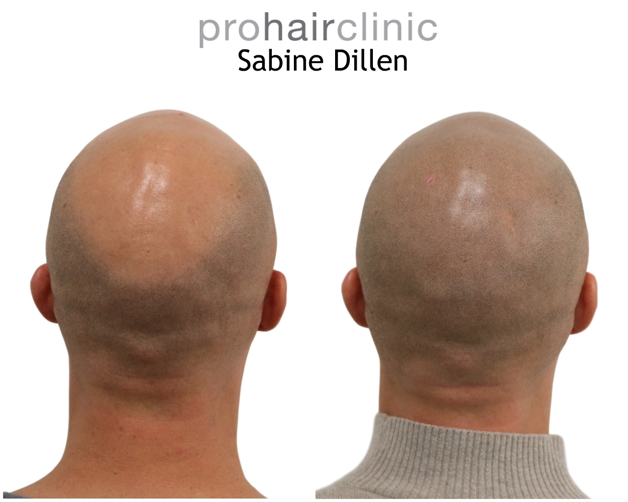 /foren/transplant/index.php/fa/48419/0/