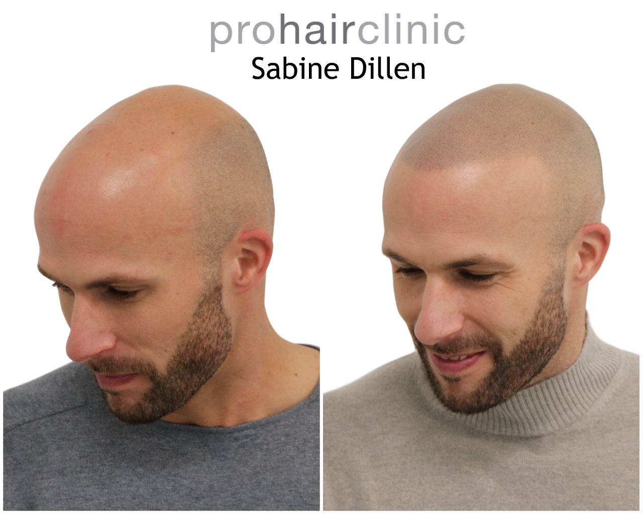 /foren/transplant/index.php/fa/48420/0/