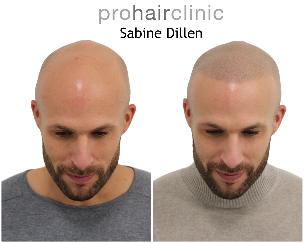 /foren/transplant/index.php/fa/48422/0/