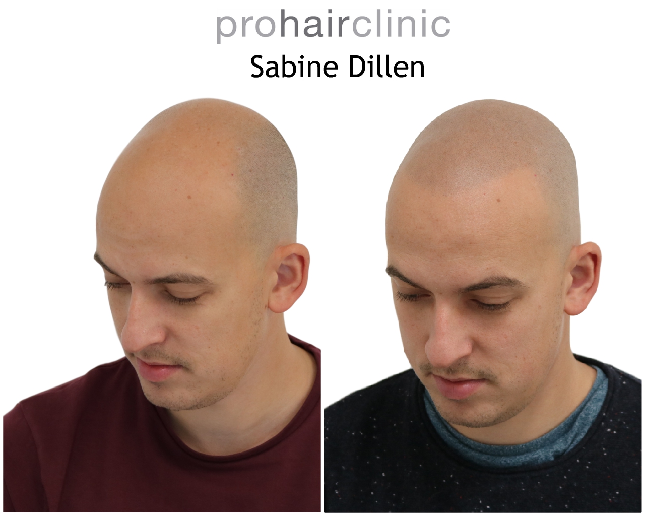 /foren/transplant/index.php/fa/48483/0/