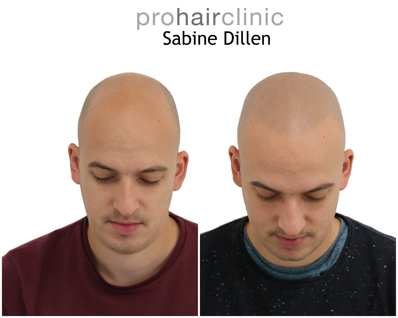 /foren/transplant/index.php/fa/48486/0/