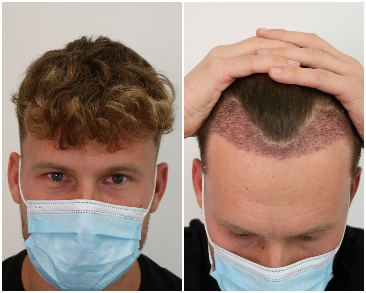 /foren/transplant/index.php/fa/48525/0/