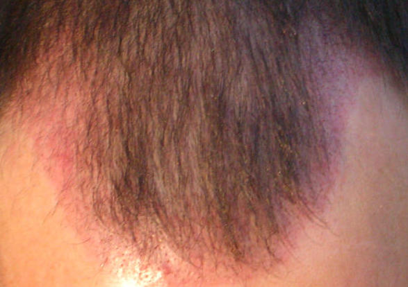 index.php/fa/4863/0/