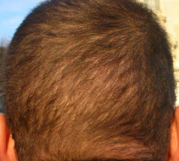 index.php/fa/4866/0/