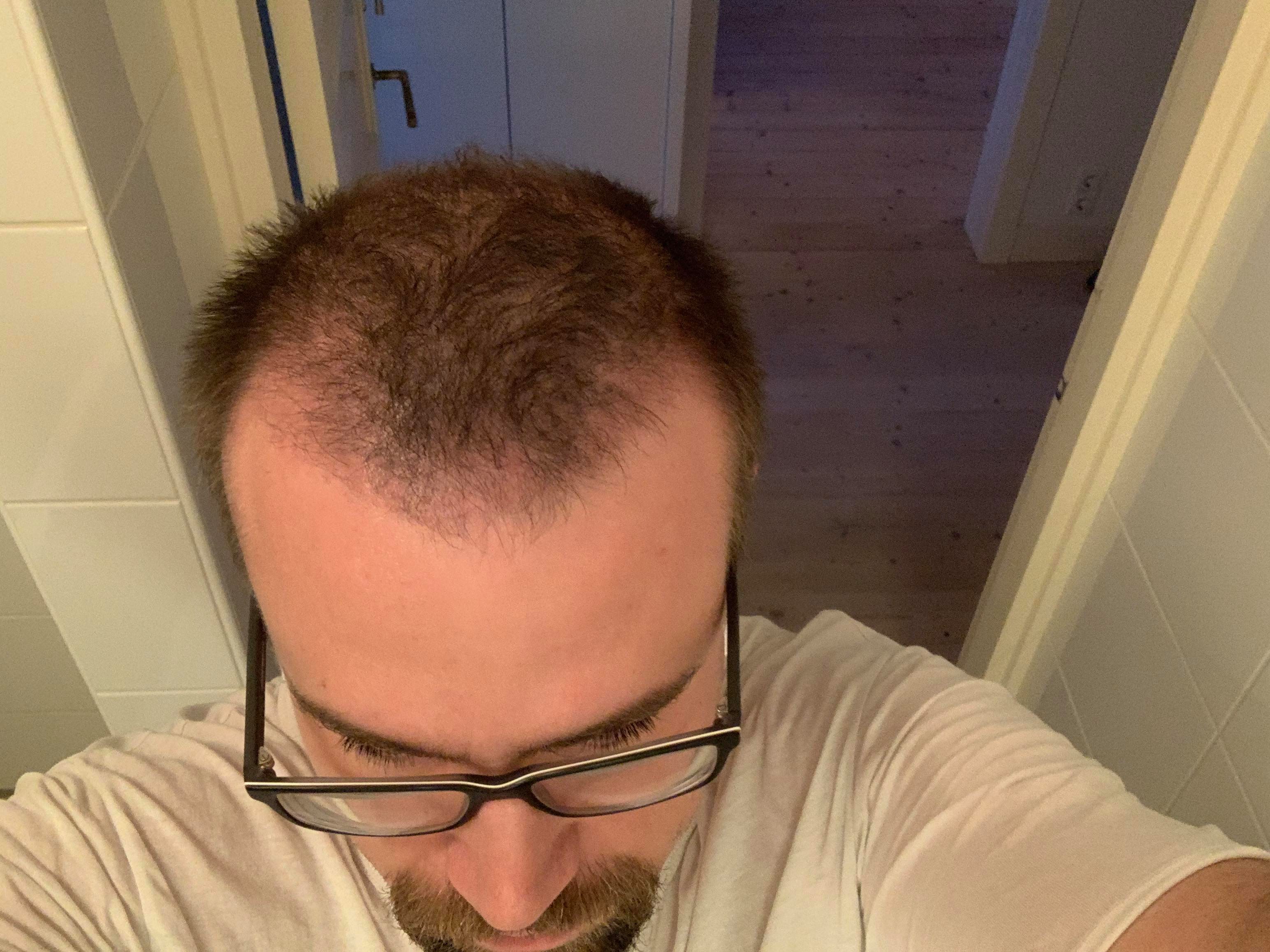 /foren/transplant/index.php/fa/48684/0/