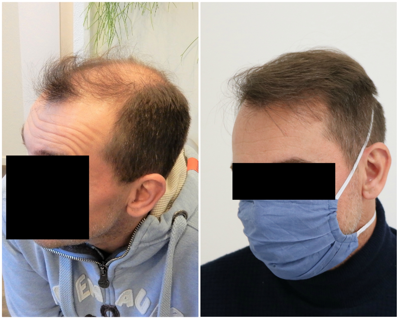 /foren/transplant/index.php/fa/48812/0/