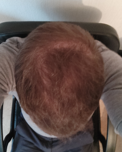 /foren/transplant/index.php/fa/48851/0/