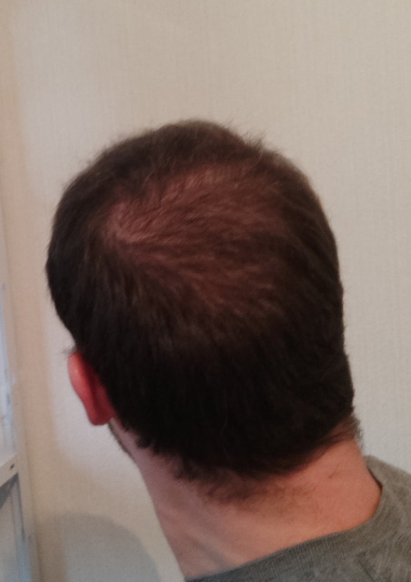 /foren/transplant/index.php/fa/48852/0/