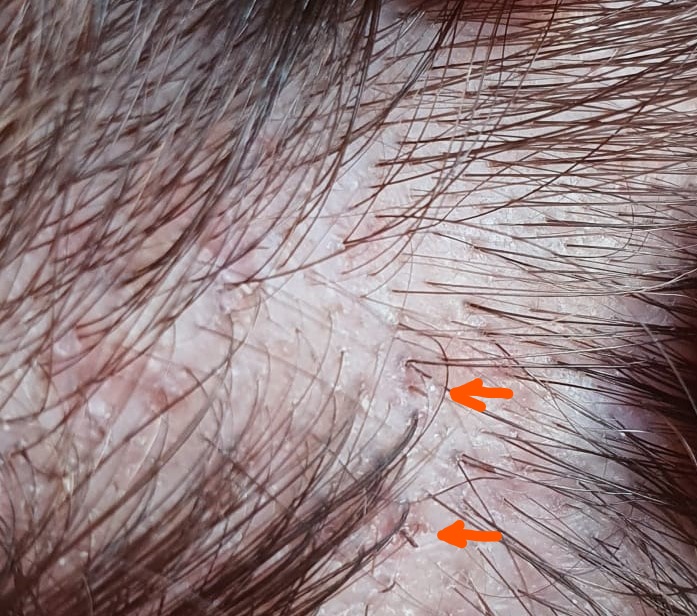 /foren/transplant/index.php/fa/48853/0/