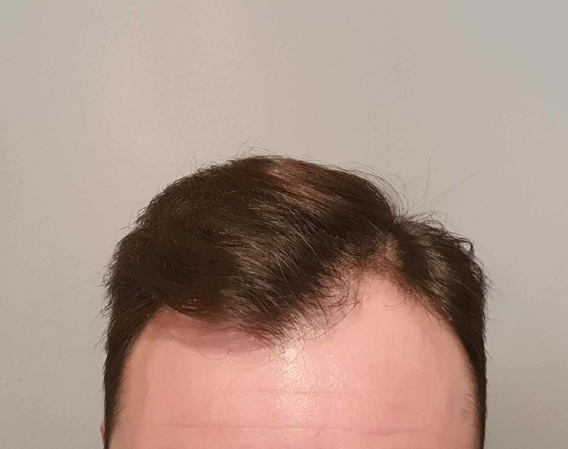 /foren/transplant/index.php/fa/48902/0/