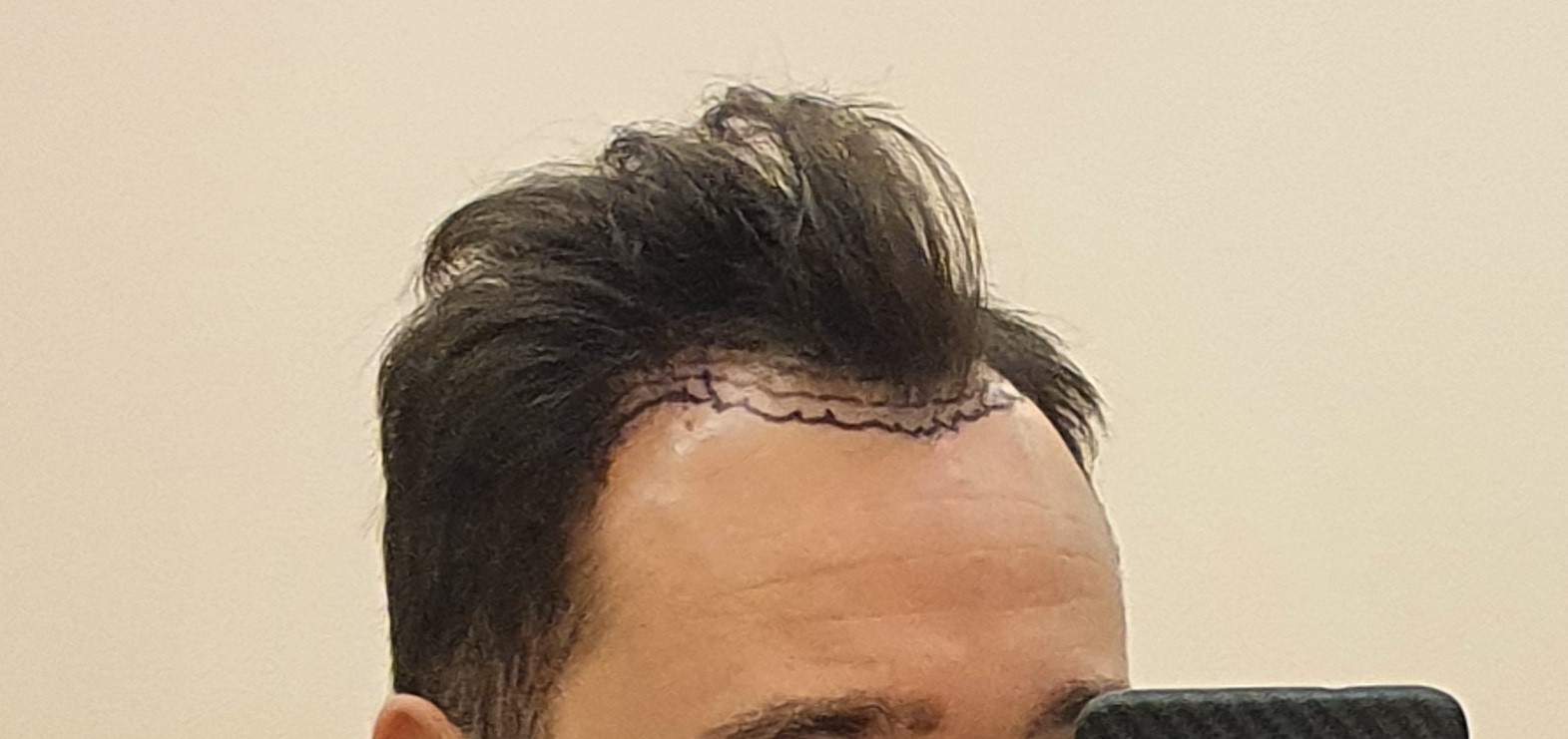 /foren/transplant/index.php/fa/48903/0/