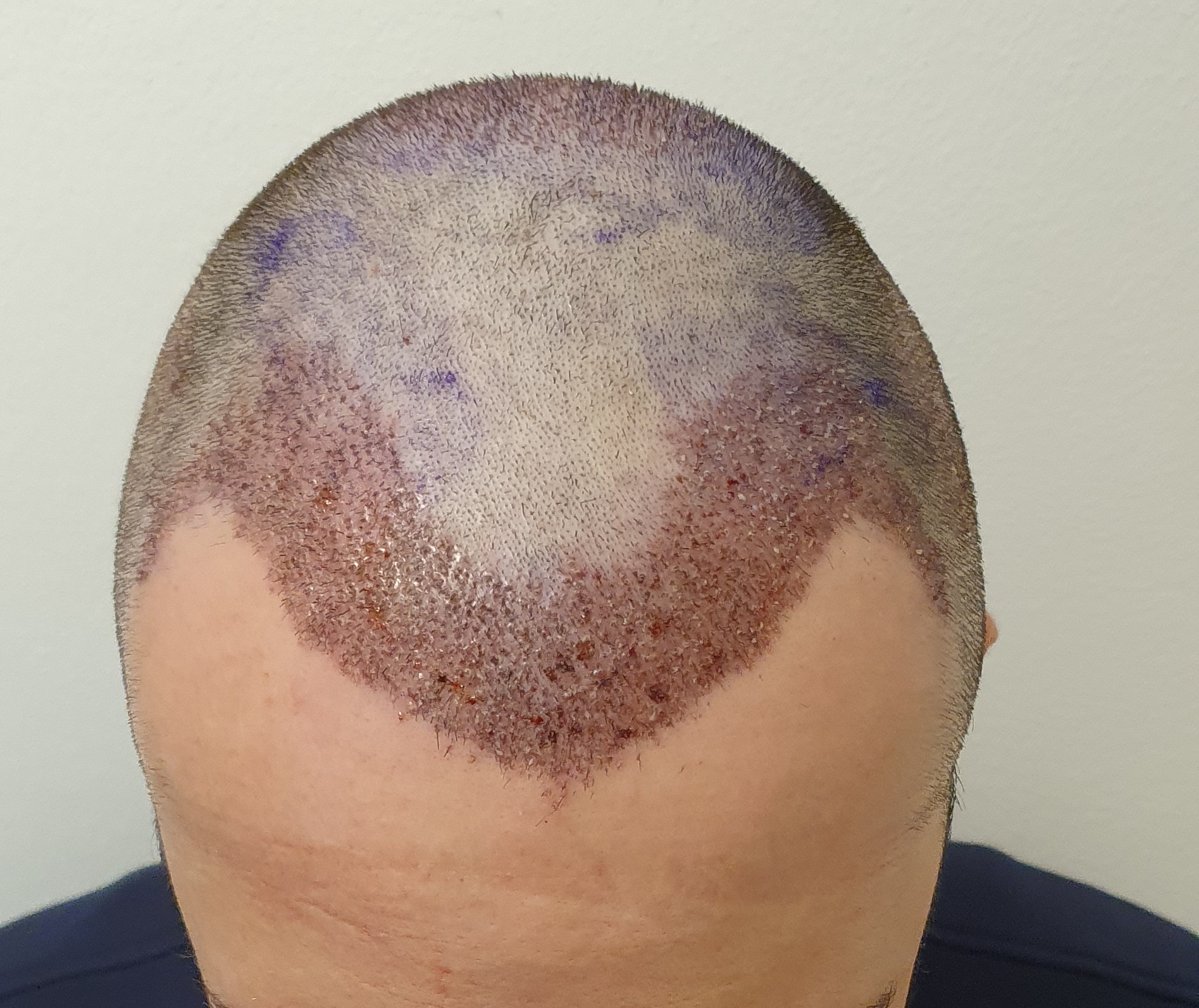 /foren/transplant/index.php/fa/48905/0/