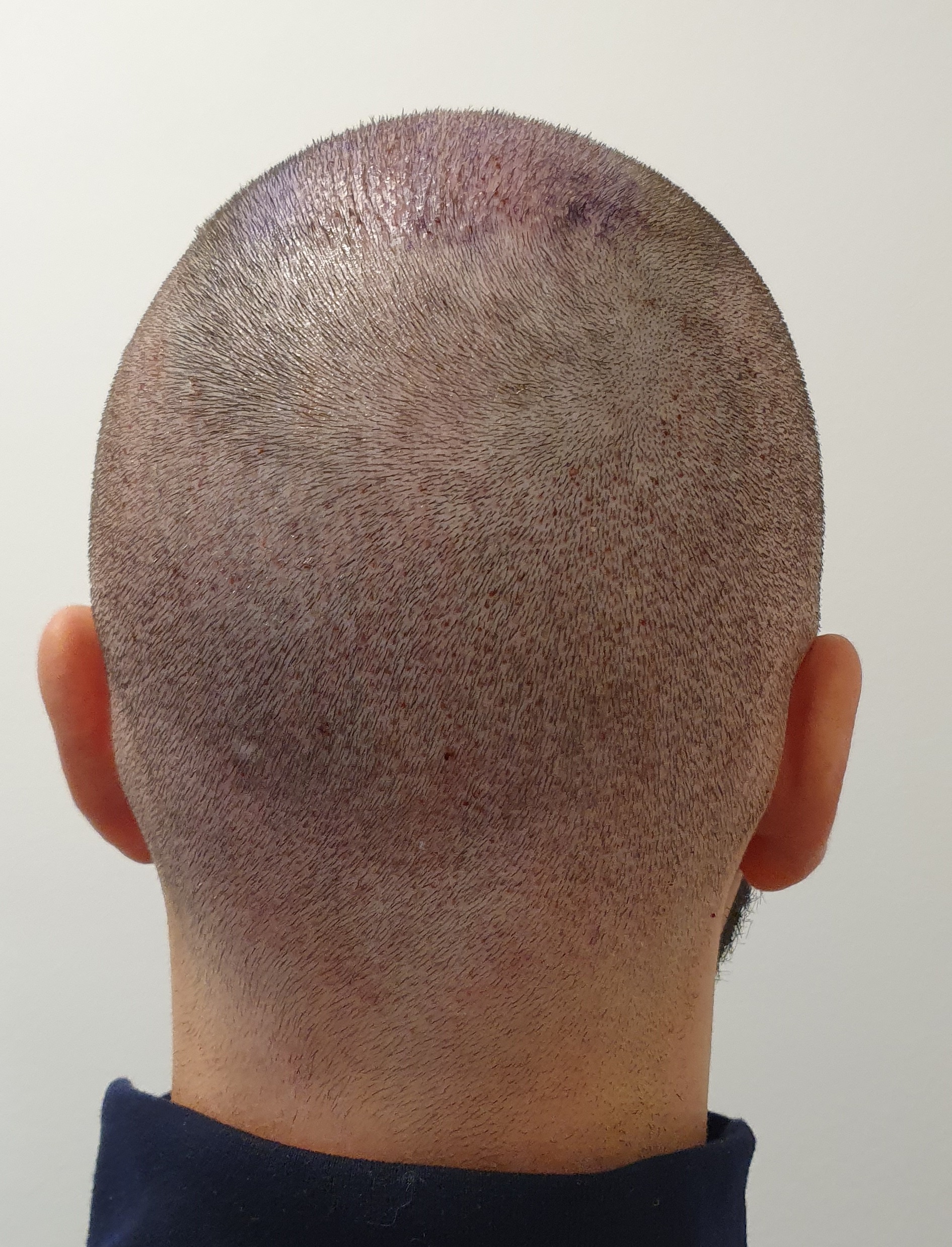 /foren/transplant/index.php/fa/48906/0/