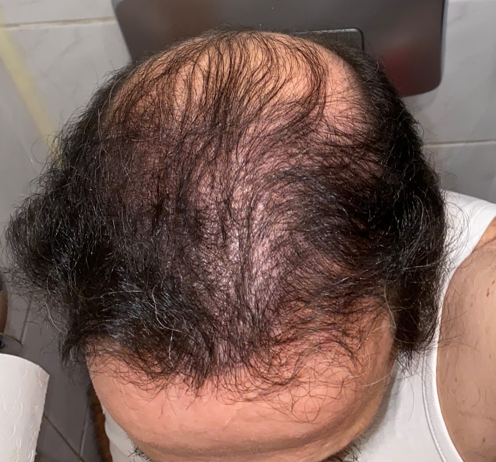 /foren/transplant/index.php/fa/48929/0/