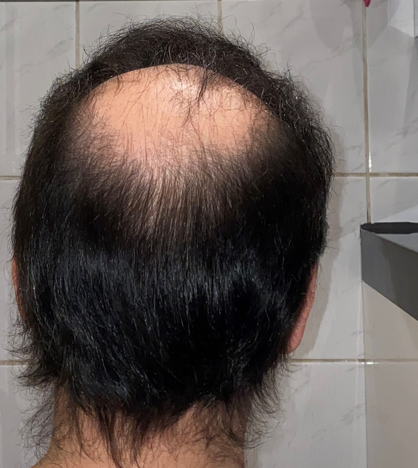 /foren/transplant/index.php/fa/48932/0/