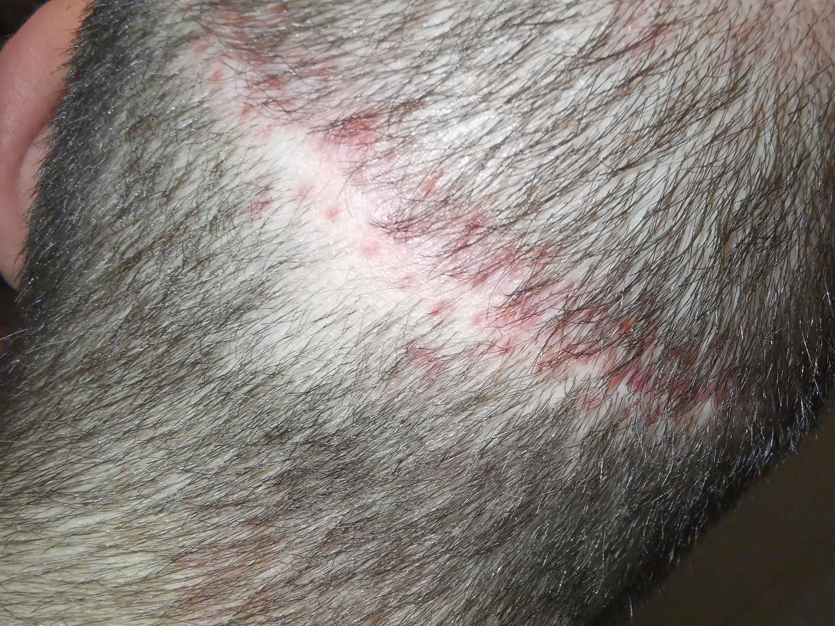 /foren/transplant/index.php/fa/48946/0/