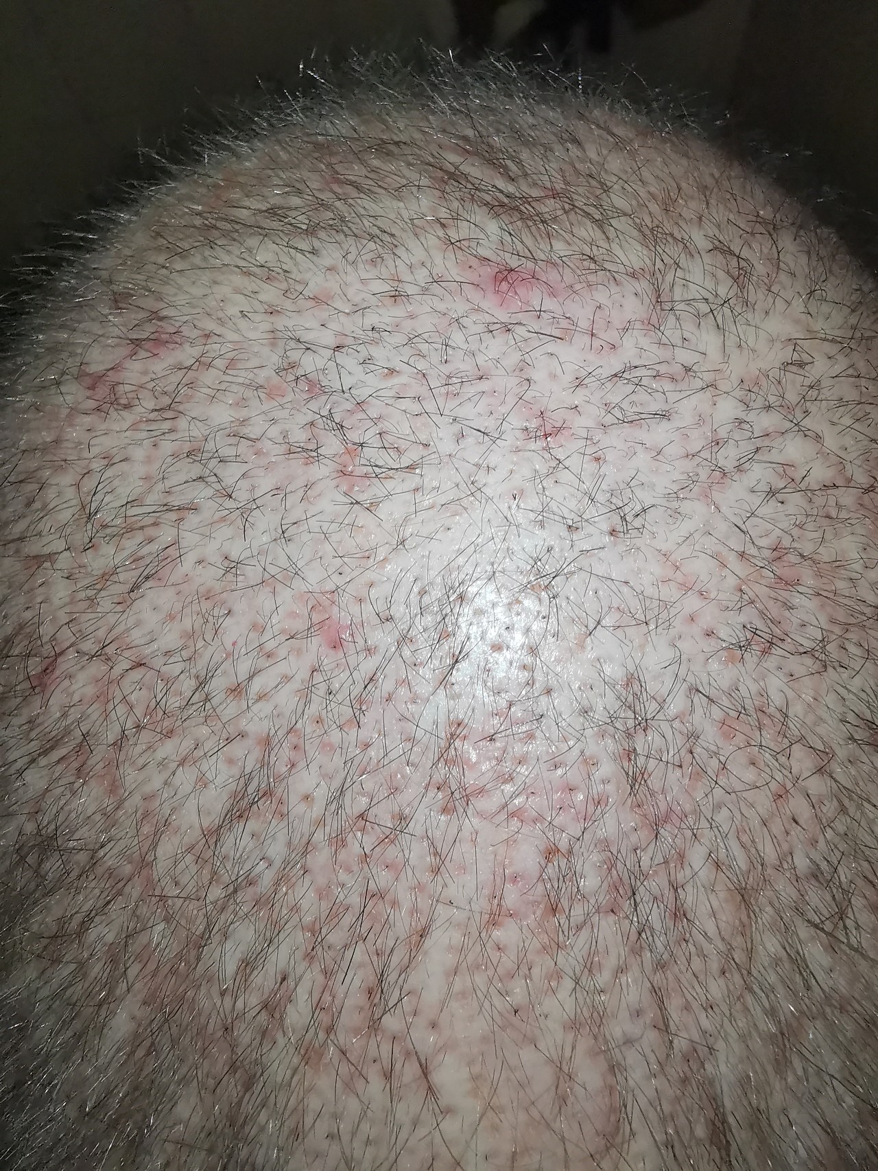 /foren/transplant/index.php/fa/48947/0/