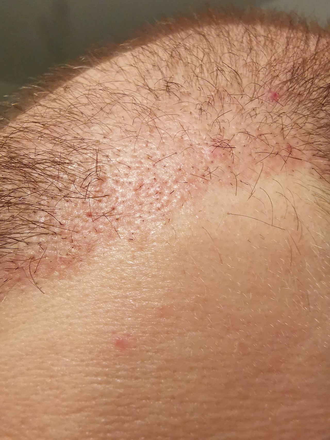 /foren/transplant/index.php/fa/48948/0/