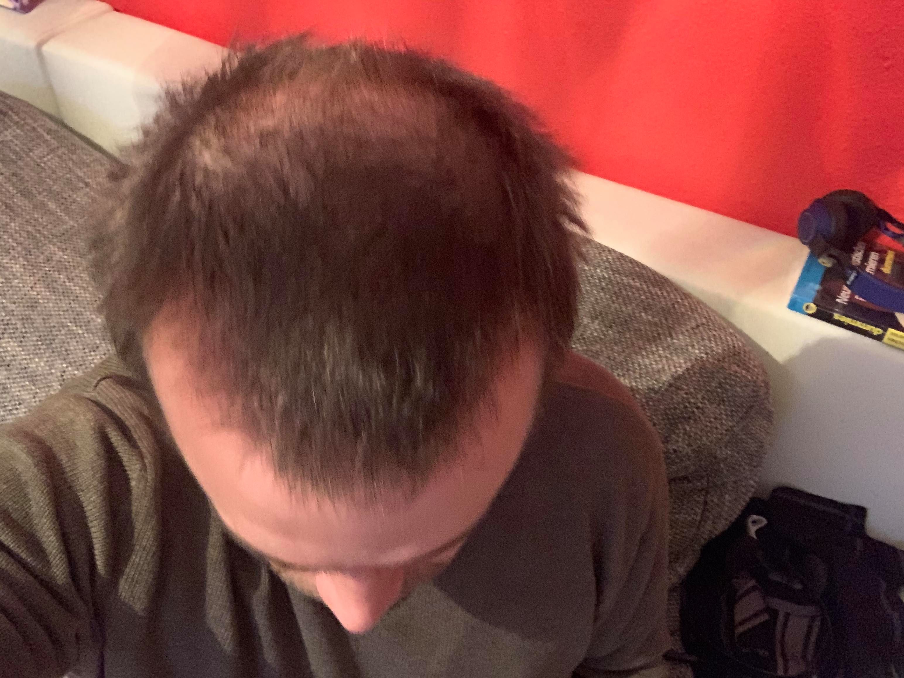 /foren/transplant/index.php/fa/49027/0/