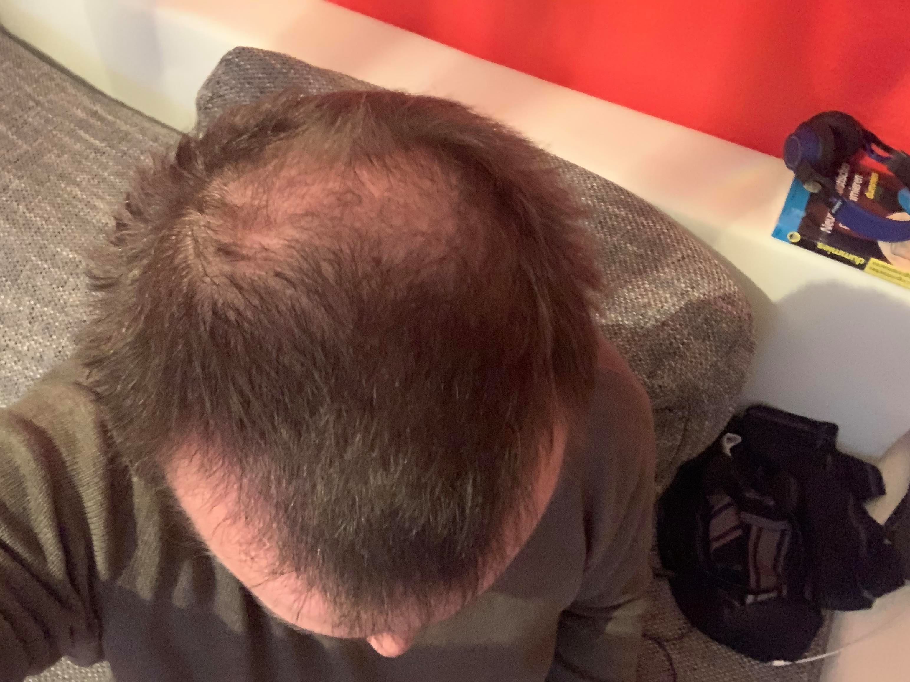 /foren/transplant/index.php/fa/49028/0/