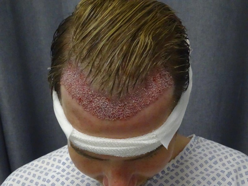 /foren/transplant/index.php/fa/49067/0/