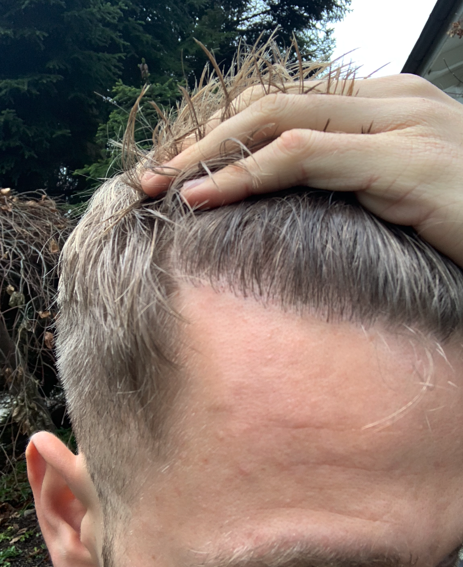 /foren/transplant/index.php/fa/49313/0/