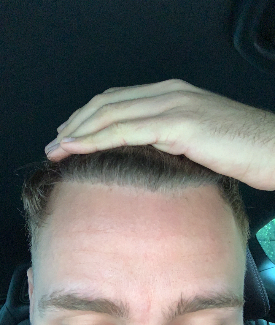 /foren/transplant/index.php/fa/49314/0/