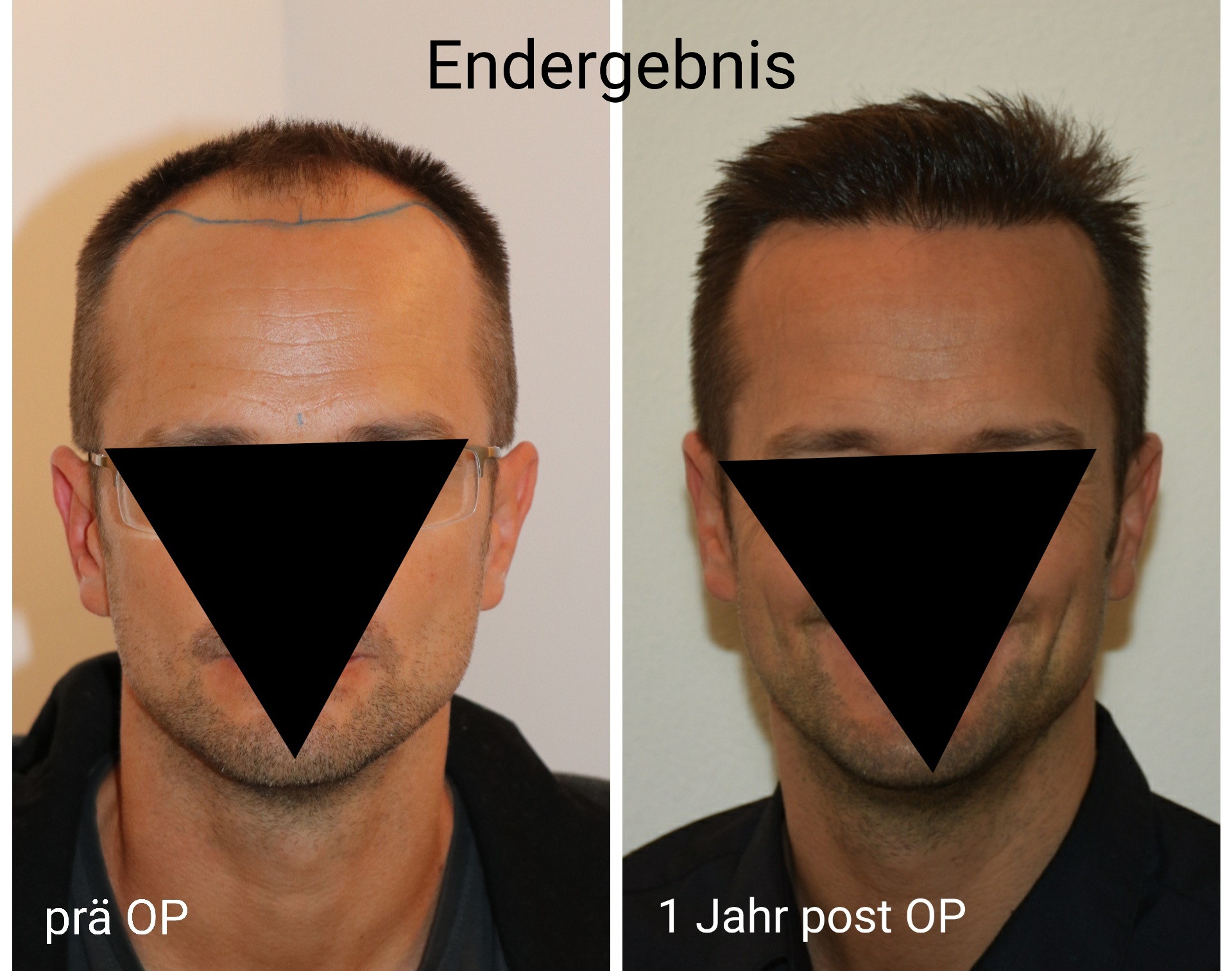 /foren/transplant/index.php/fa/49328/0/