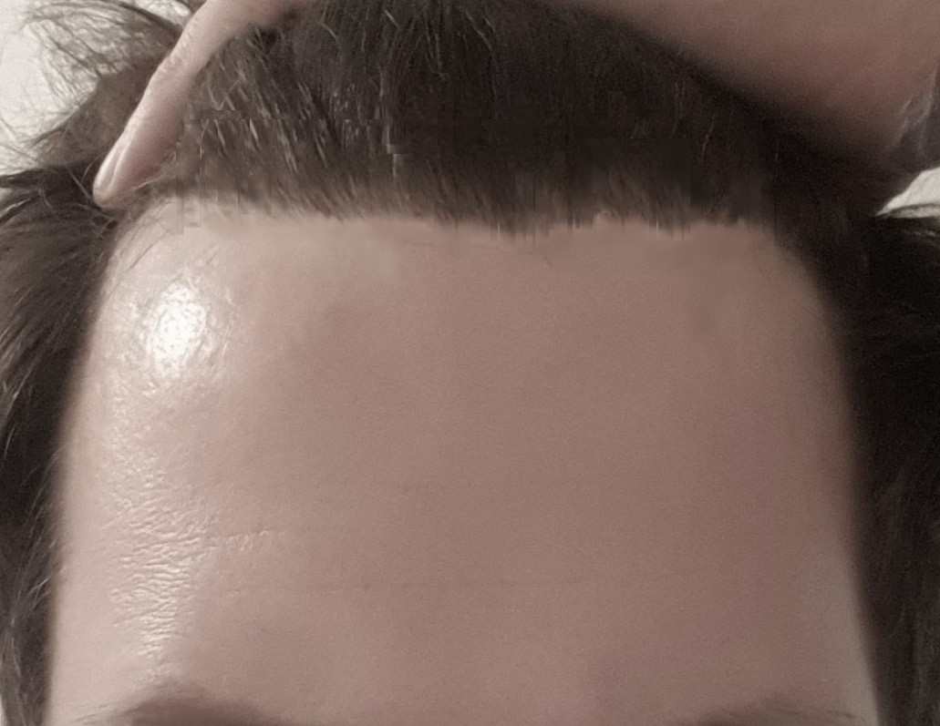 /foren/transplant/index.php/fa/49435/0/