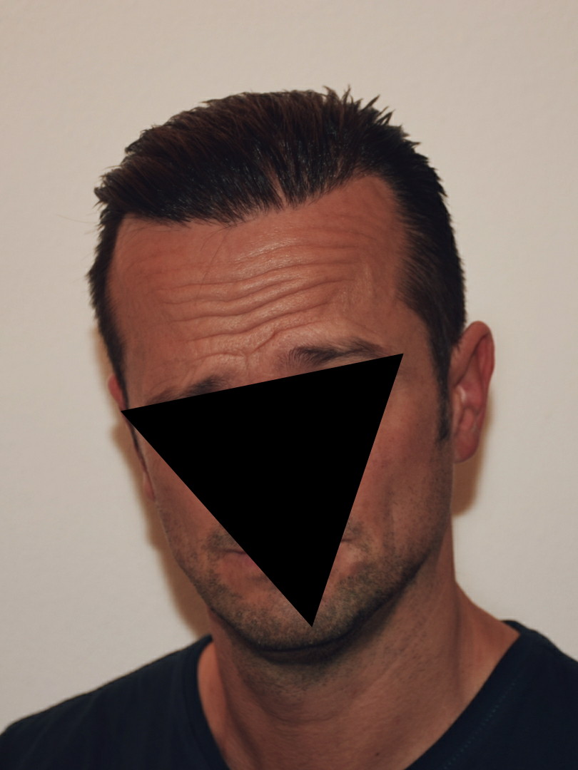 /foren/transplant/index.php/fa/49438/0/