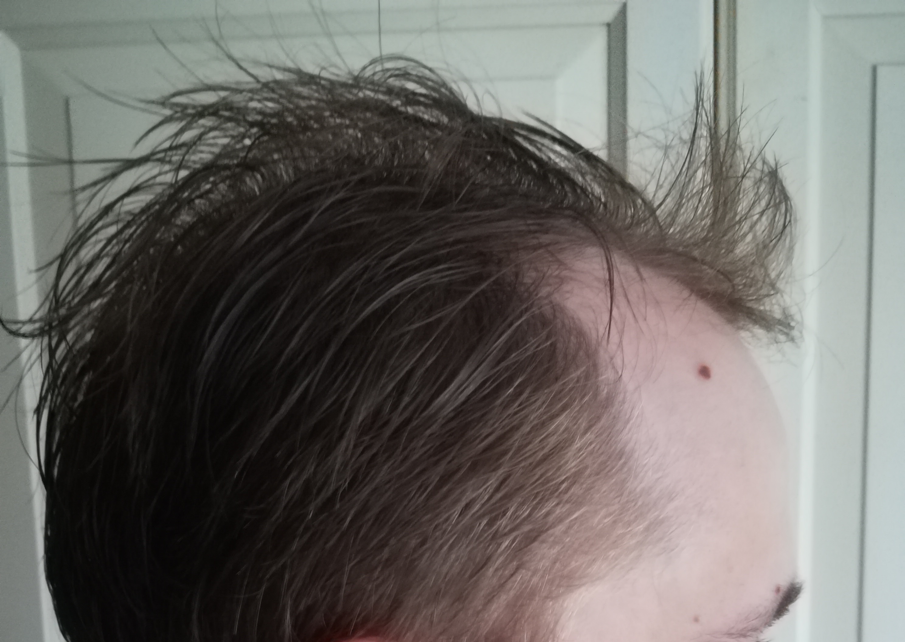 /foren/transplant/index.php/fa/49440/0/