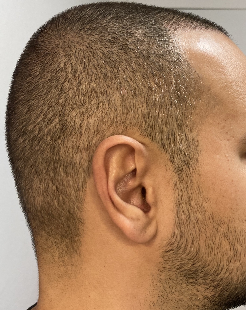 /foren/transplant/index.php/fa/49506/0/