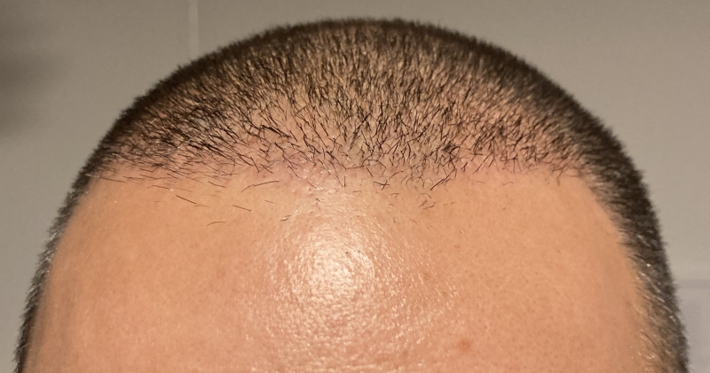 /foren/transplant/index.php/fa/49507/0/