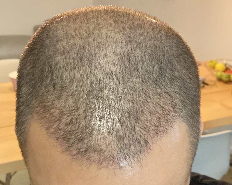 /foren/transplant/index.php/fa/49508/0/