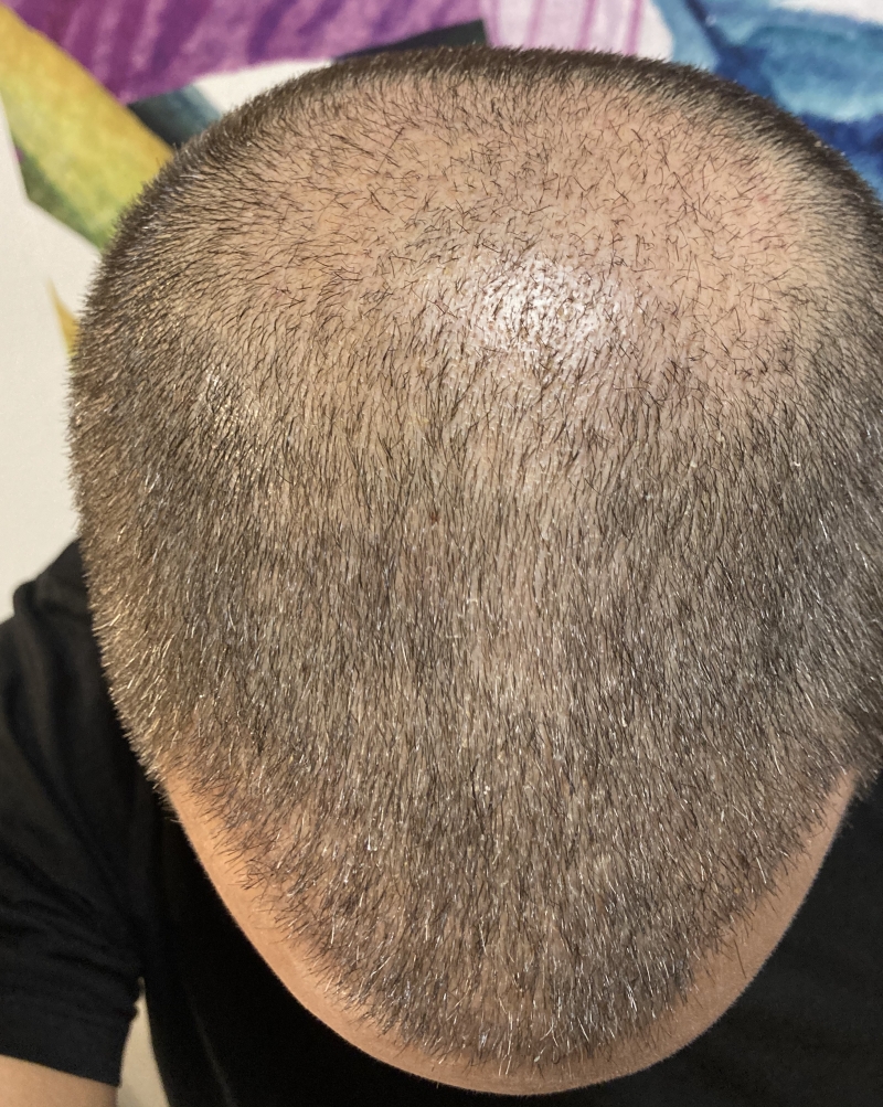 /foren/transplant/index.php/fa/49509/0/