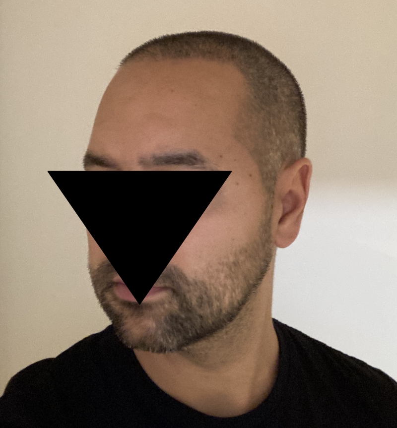 /foren/transplant/index.php/fa/49511/0/